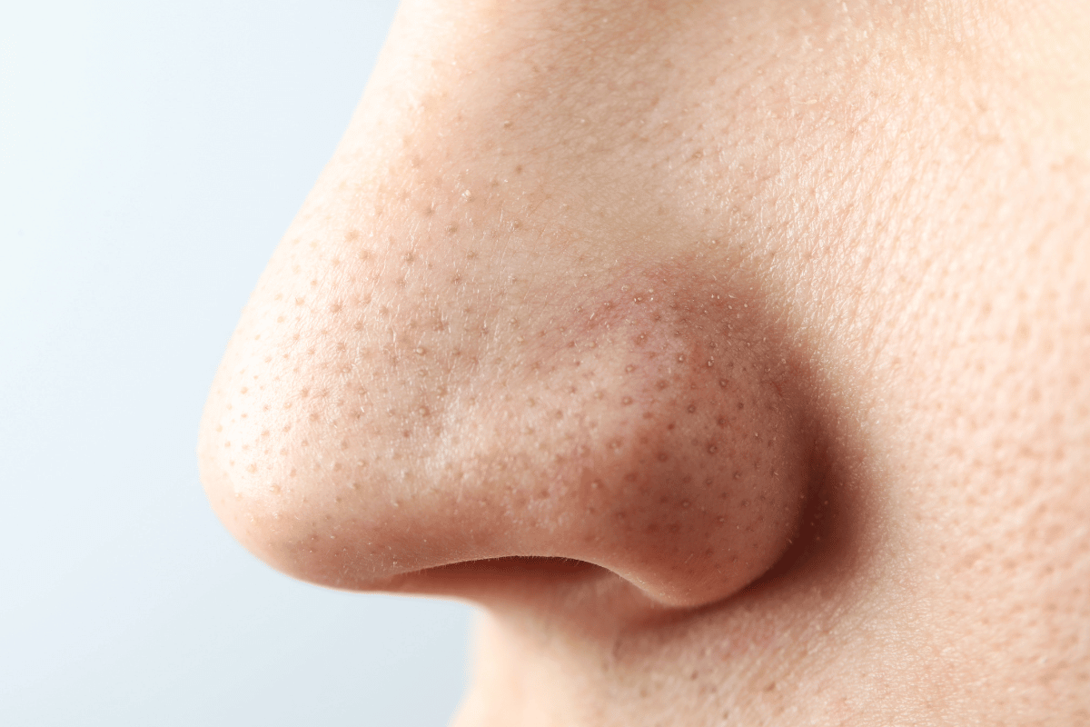 How To Clear Your Pores With A Scrub?